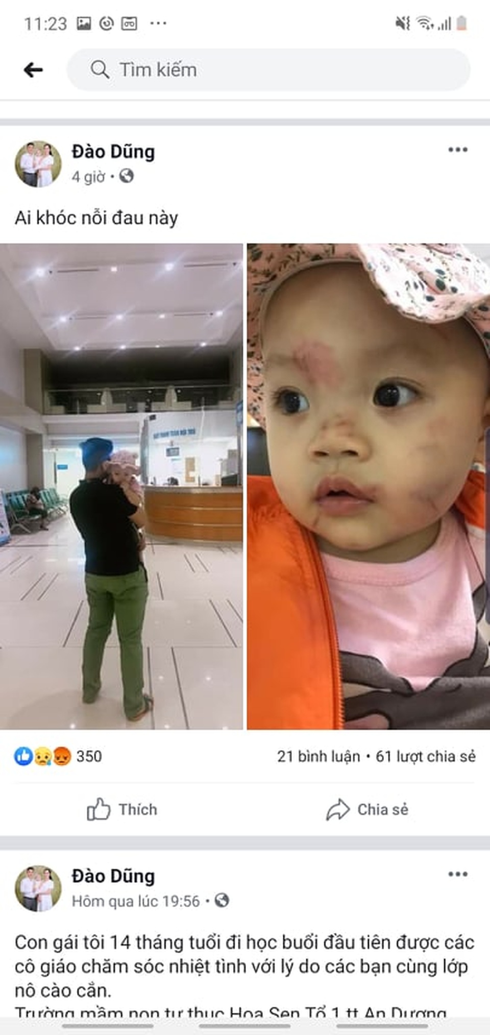 Vụ bé gái 14 tháng tuổi bị nhiều vết thương trên mặt: Công an kết luận do bạn cùng lớp cắn - 1 Vụ bé gái 14 tháng tuổi bị nhiều vết thương trên mặt: Công an kết luận do bạn cùng lớp cắn - 1