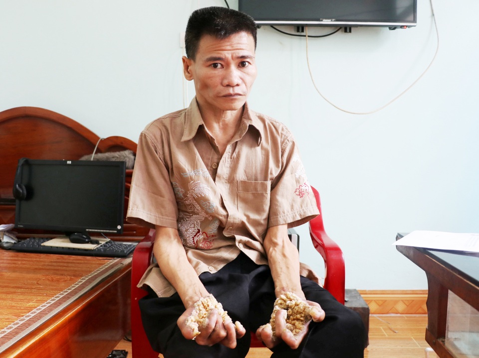 Thăm người đàn ông mang bệnh “người cây” ở Ninh Bình - 1 Thăm người đàn ông mang bệnh “người cây” ở Ninh Bình - 1