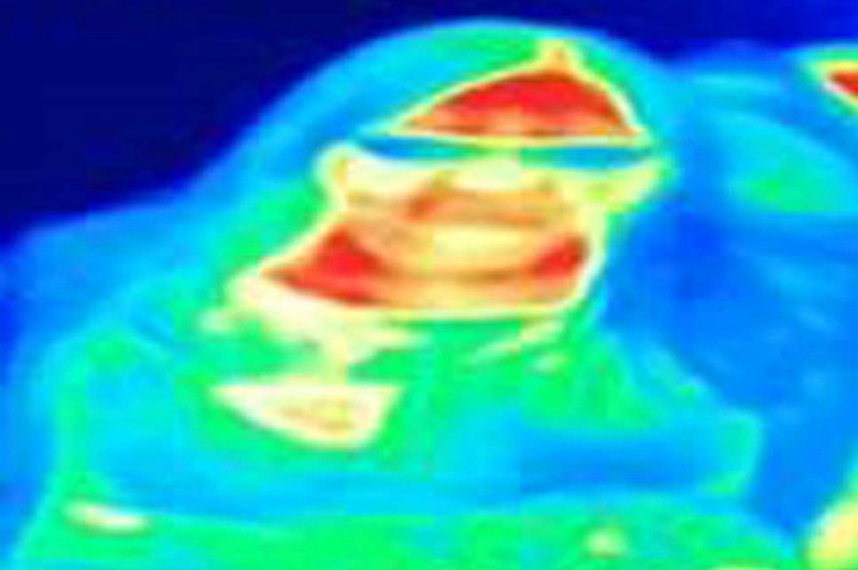 Phát hiện ung thư vú nhờ chụp ảnh nhiệt trong bảo tàng - 1