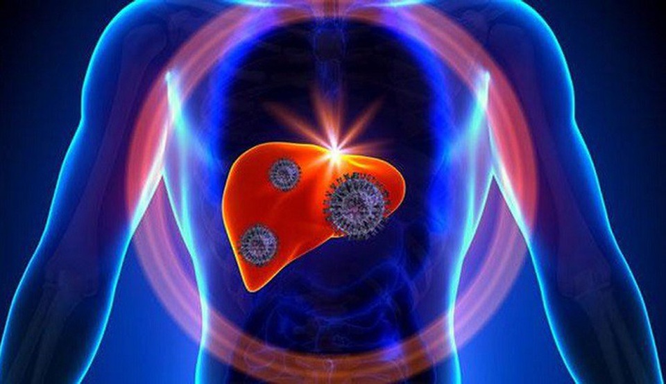 Ung thư gan - Bệnh có tỷ lệ mắc mới nhiều nhất hiện nay tại Việt Nam - 1