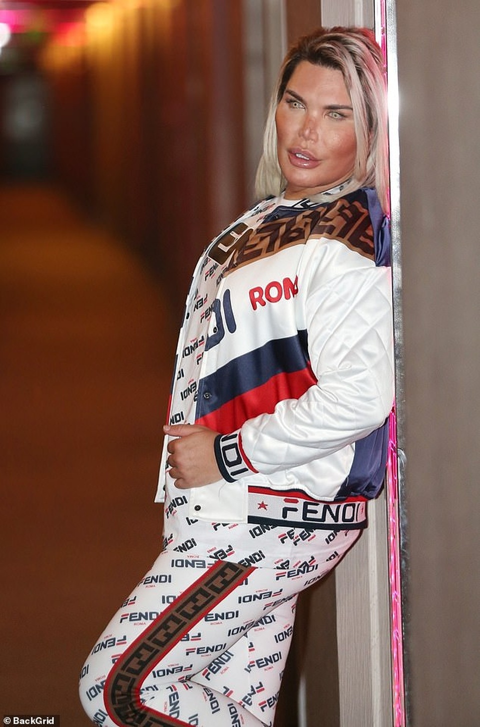 Búp bê Ken Rodrigo Alves tiếp tục phẫu thuật thẩm mỹ - 5 Búp bê Ken Rodrigo Alves tiếp tục phẫu thuật thẩm mỹ - 5