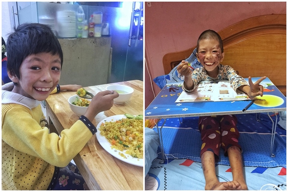 Chuyện cảm động về cô gái Hà Nội xinh đẹp từng bị kỳ thị vì nhận nuôi bé gái lở loét - 2 Chuyện cảm động về cô gái Hà Nội xinh đẹp từng bị kỳ thị vì nhận nuôi bé gái lở loét - 2