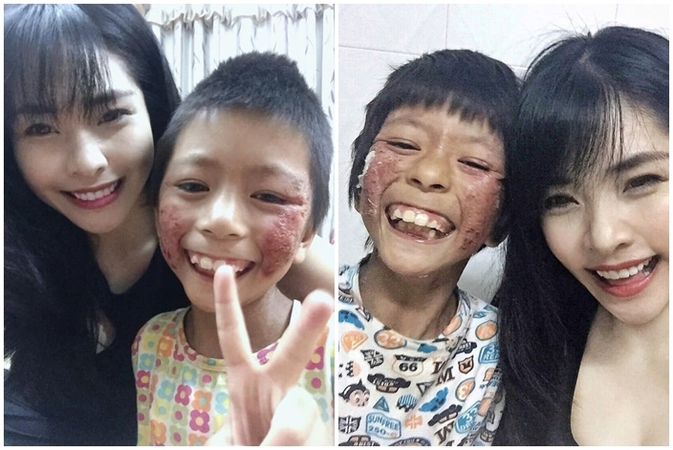 Chuyện cảm động về cô gái Hà Nội xinh đẹp từng bị kỳ thị vì nhận nuôi bé gái lở loét - 4 Chuyện cảm động về cô gái Hà Nội xinh đẹp từng bị kỳ thị vì nhận nuôi bé gái lở loét - 4