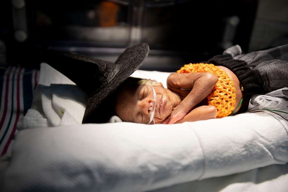 Dễ thương bé sơ sinh thiếu tháng diện đồ hóa trang đón Halloween trong bệnh viện - 2 Dễ thương bé sơ sinh thiếu tháng diện đồ hóa trang đón Halloween trong bệnh viện - 2