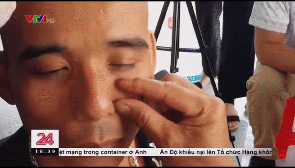 Chữa viêm xoang bằng cách bắt sâu trên mặt: Bác sĩ tai mũi họng nói gì? - 3 Chữa viêm xoang bằng cách bắt sâu trên mặt: Bác sĩ tai mũi họng nói gì? - 3