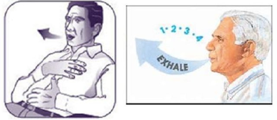 Người bệnh ung thư nên tập thở chúm môi - 1 Người bệnh ung thư nên tập thở chúm môi - 1