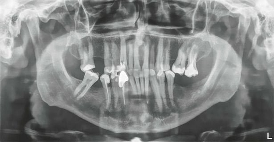 Lập kỷ lục thế giới nhờ chiếc răng dị thường - 1 Lập kỷ lục thế giới nhờ chiếc răng dị thường - 1