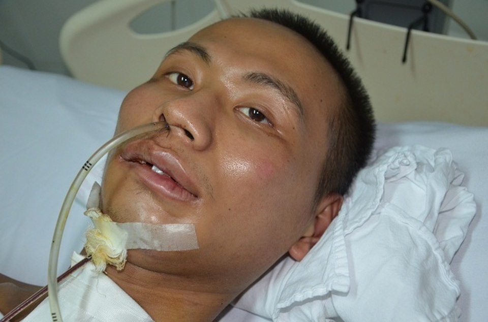 Ám ảnh đôi mắt khát thèm sự sống của chàng trai bị ngã từ tầng 5 xuống đất - 1 Ám ảnh đôi mắt khát thèm sự sống của chàng trai bị ngã từ tầng 5 xuống đất - 1
