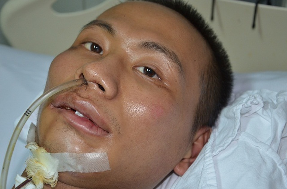 Ám ảnh đôi mắt khát thèm sự sống của chàng trai bị ngã từ tầng 5 xuống đất - 5 Ám ảnh đôi mắt khát thèm sự sống của chàng trai bị ngã từ tầng 5 xuống đất - 5