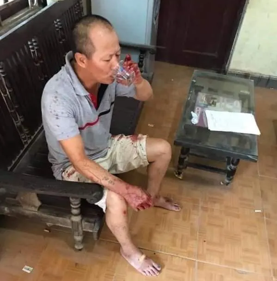 Ký ức hãi hùng của nữ nạn nhân sống sót trong vụ thảm án ở Đan Phượng - 4 Ký ức hãi hùng của nữ nạn nhân sống sót trong vụ thảm án ở Đan Phượng - 4
