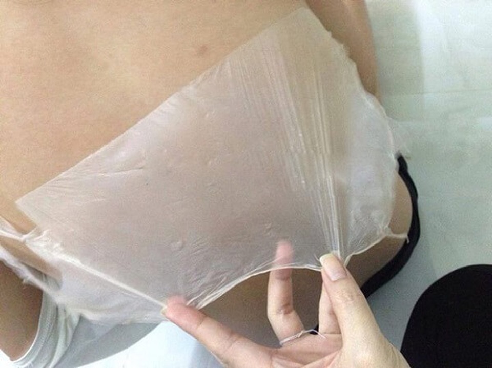 Bác sĩ da liễu cảnh báo rủi ro từ phương pháp “lột trắng da siêu tốc” - 1