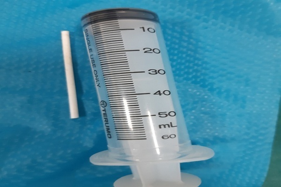 Quảng Bình: Ăn kẹo mút, bé trai 2 tuổi nuốt luôn que nhựa 5cm vào bụng - 2 Quảng Bình: Ăn kẹo mút, bé trai 2 tuổi nuốt luôn que nhựa 5cm vào bụng - 2