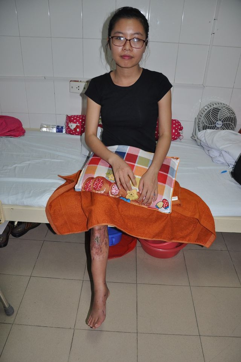 Cô gái trẻ bị ô tô nghiến đứt chân đã trở thành nữ bác sĩ - 3 Cô gái trẻ bị ô tô nghiến đứt chân đã trở thành nữ bác sĩ - 3