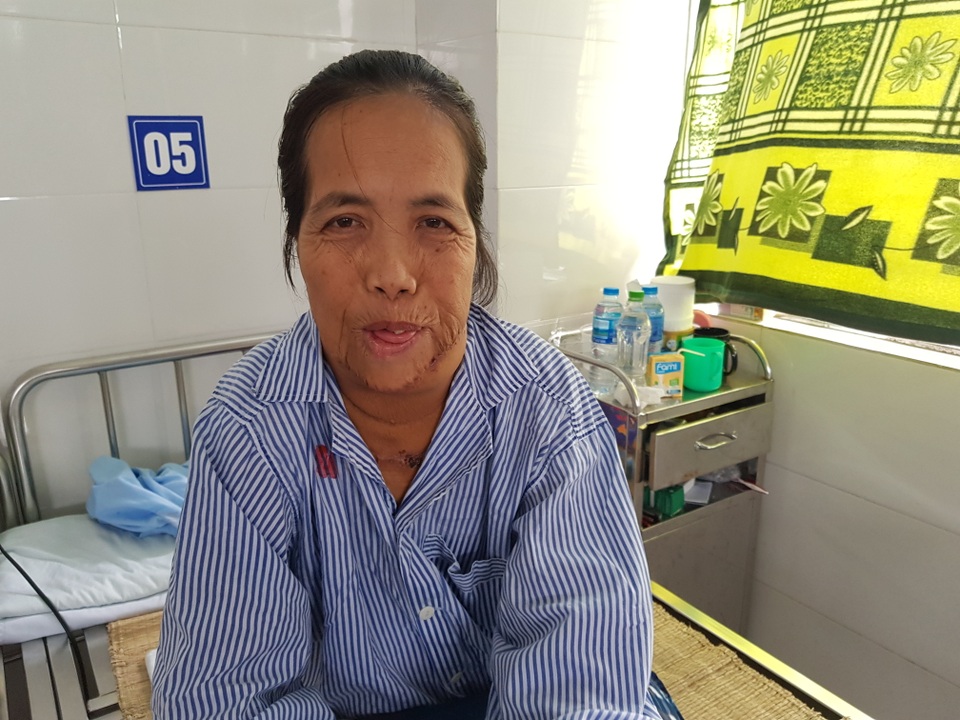 Người đàn bà có hàm răng kì dị lần đầu ngoái cổ sau nửa thế kỉ: Em sợ mẹ không nhận ra - 6 Người đàn bà có hàm răng kì dị lần đầu ngoái cổ sau nửa thế kỉ: Em sợ mẹ không nhận ra - 6