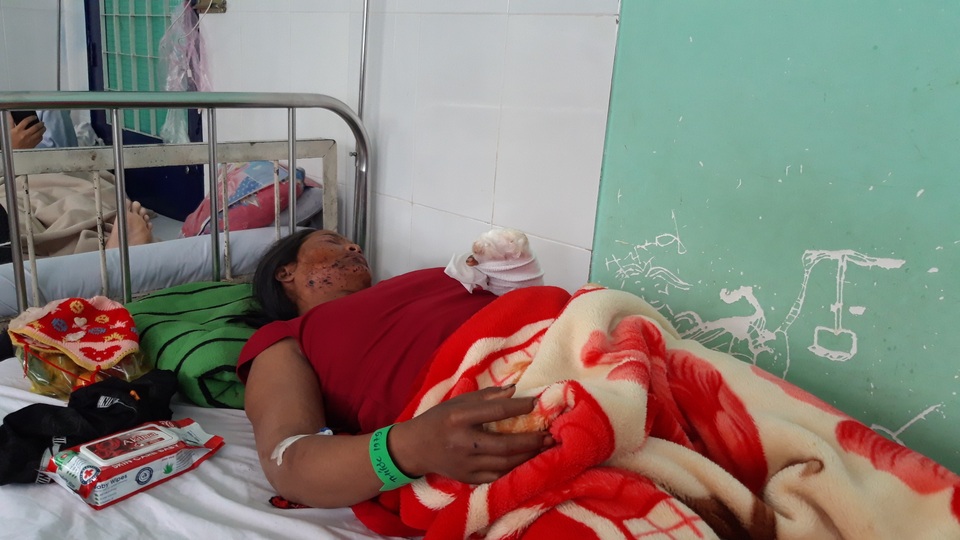 Vụ nổ đầu đạn pháo 9 người bị thương: Bé gái 22 tháng tuổi đang nguy kịch - 1 Vụ nổ đầu đạn pháo 9 người bị thương: Bé gái 22 tháng tuổi đang nguy kịch - 1