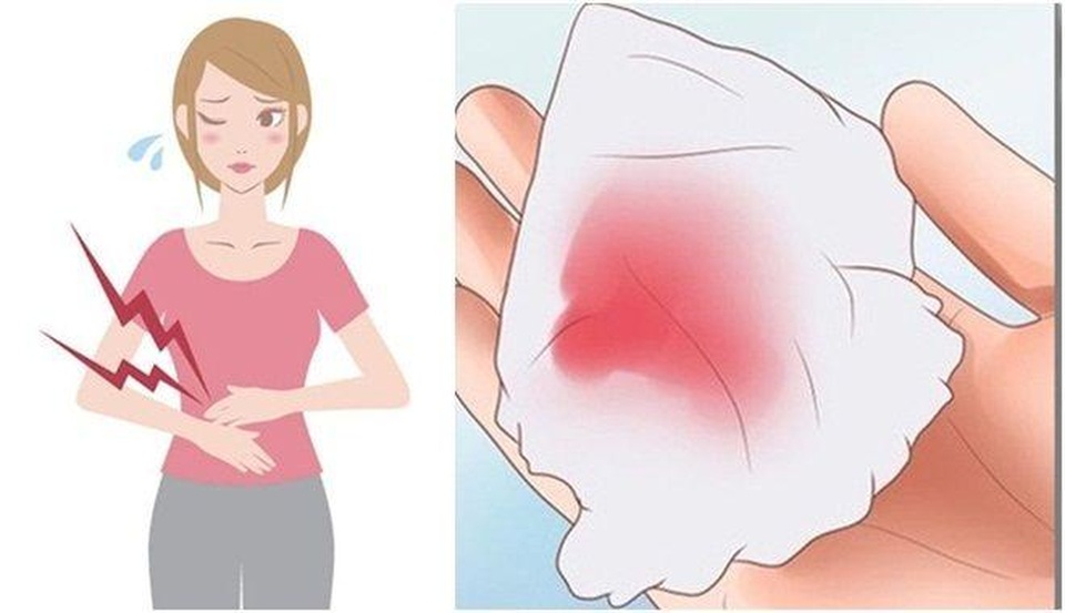 Những điều cần biết về u nang buồng trứng và giải pháp cải thiện bệnh nhờ Nga Phụ Khang - 2 Những điều cần biết về u nang buồng trứng và giải pháp cải thiện bệnh nhờ Nga Phụ Khang - 2