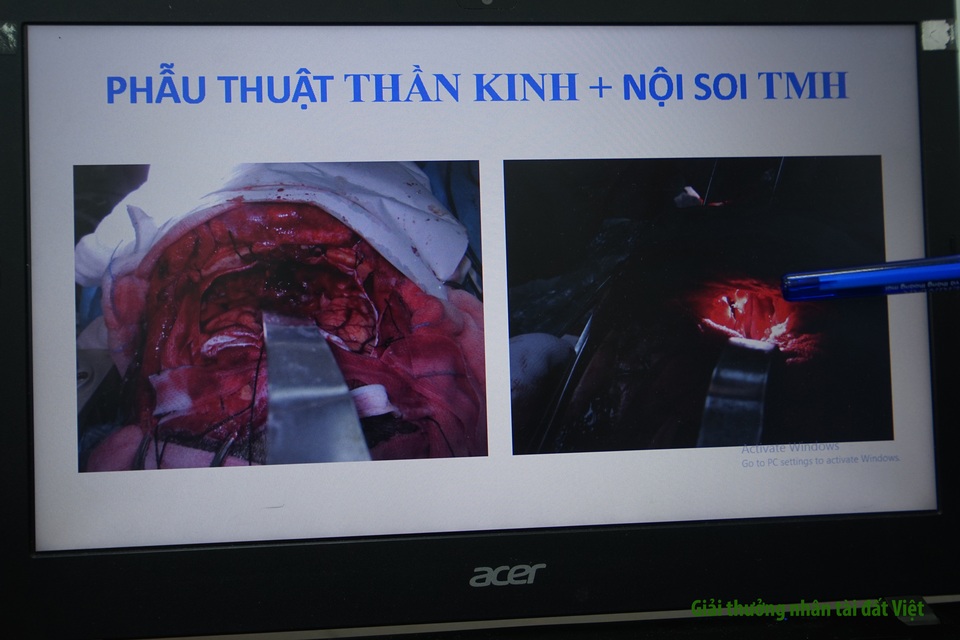 BV Chợ Rẫy: Phương pháp phẫu thuật 3 trong 1 giúp người bệnh thoát “án tử” - 7 BV Chợ Rẫy: Phương pháp phẫu thuật 3 trong 1 giúp người bệnh thoát “án tử” - 7