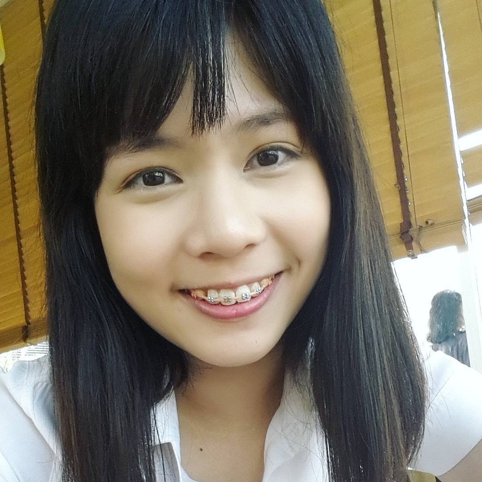 Trước khi sở hữu nhan sắc hoàn mỹ, tân hoa hậu quốc tế từng phải niềng răng - 6 Trước khi sở hữu nhan sắc hoàn mỹ, tân hoa hậu quốc tế từng phải niềng răng - 6