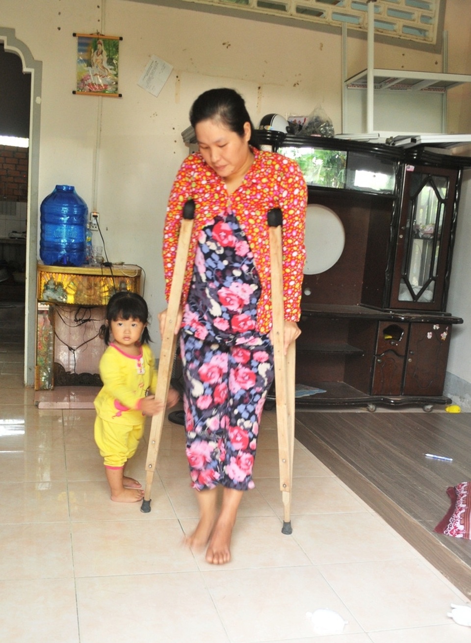 Khổ cảnh vợ chống nạng thăm chồng bị điện giật cháy khét 2 chân - 4 Khổ cảnh vợ chống nạng thăm chồng bị điện giật cháy khét 2 chân - 4