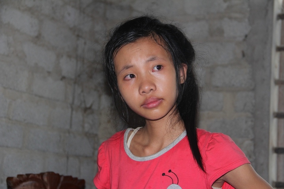 Nỗi đau tột cùng của cô bé học giỏi phải nghỉ học vì không có tiền chữa trị chân - 7 Chỉ mấy tháng Linh sụt hơn 12 ký, người gầy khô, xanh xao.