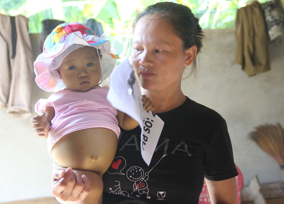 Các bác sĩ ở TP.HCM kết luận bé Hoài Nhi bị teo ống mật bẩm sinh, xơ gan không có cách cứu chữa.