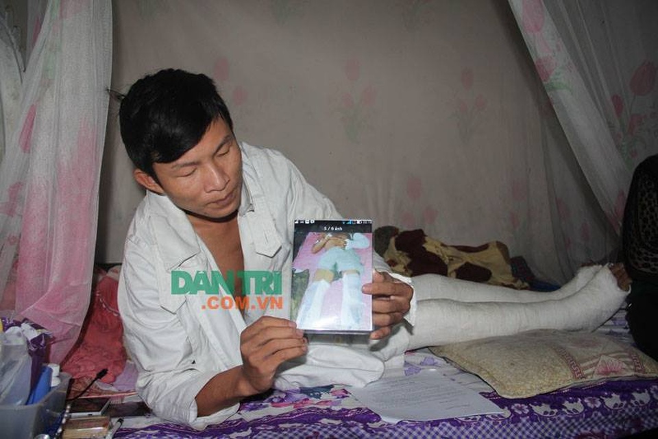 Rùng mình nam MC đám cưới bị trận đòn nhừ tử vì nghi… trộm chó - 1
Anh Nguyễn Nam Trường đang nằm dưỡng thương ở nhà sau trận đòn dã man của nhiều người xảy ra ở thôn Vĩnh Thọ, xã Kỳ Thọ cách đây hơn 1 tháng.