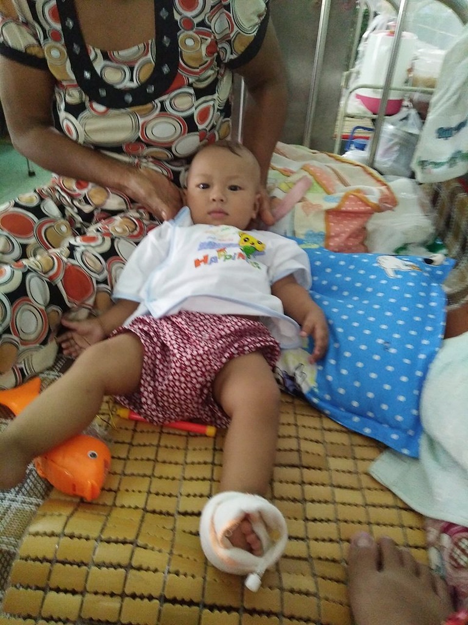 Bé trai gần 2 tuổi đứng trước ngưỡng cửa sinh tử vì bệnh hiểm nghèo - 3 Có khi bắt ven ở chân