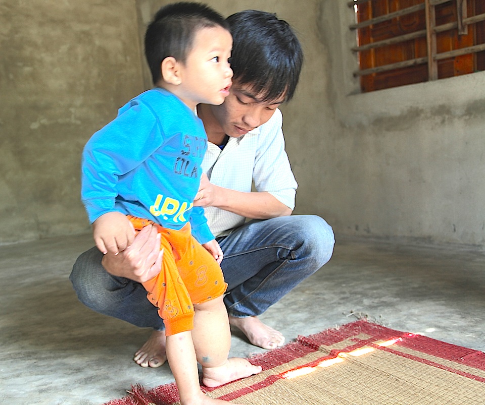 Hơn 52 triệu đồng đến với bé 3 tuổi mang nỗi đau phì đại chân tay - 5 Càng về cuối năm Danh thêm rối trí, theo lịch các bác sĩ ngoài viện Nhi Hà Nội hẹn phẫu thuật cho bé Minh càng lúc cận kề. Mà đâu phải ca bình thường, chẳng có bảo hiểm y tế nào, dù chế độ là trẻ nhỏ, là người dân tộc, là hộ nghèo “bền vững”, thì cũng phải có tiền chục tiền trăm triệu người ta mới xử lý cho ca bệnh vượt khung này.