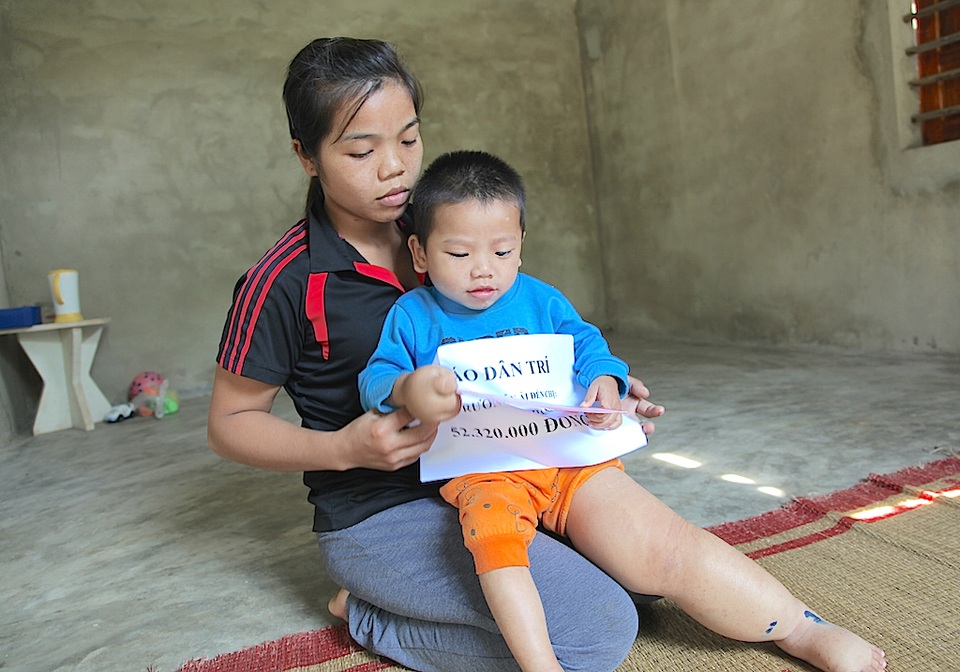 Hơn 52 triệu đồng đến với bé 3 tuổi mang nỗi đau phì đại chân tay - 3 Từ khi Minh ra đời, Danh chưa có một ngày hết lo chuyện nóng sốt ăn ngủ của con. Dẫu việc con trẻ quấy khóc trong năm tháng đầu đời không phải là chuyện lạ, nhưng ở trường hợp của Minh, chứng bệnh hiếm gặp phồng xẹp bất thường trên thân thể khiến cháu trở nên khác thường