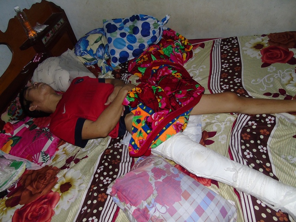 Vợ nhìn chồng hoại tử từng ngày trong bất lực - 4