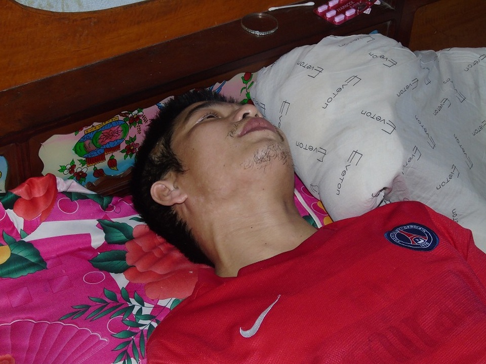 Anh Đằng nằm liệt giường, chân bó bột, gương mặt gầy gò, xanh xao đang quằn quại và rên rỉ vì đau đớn