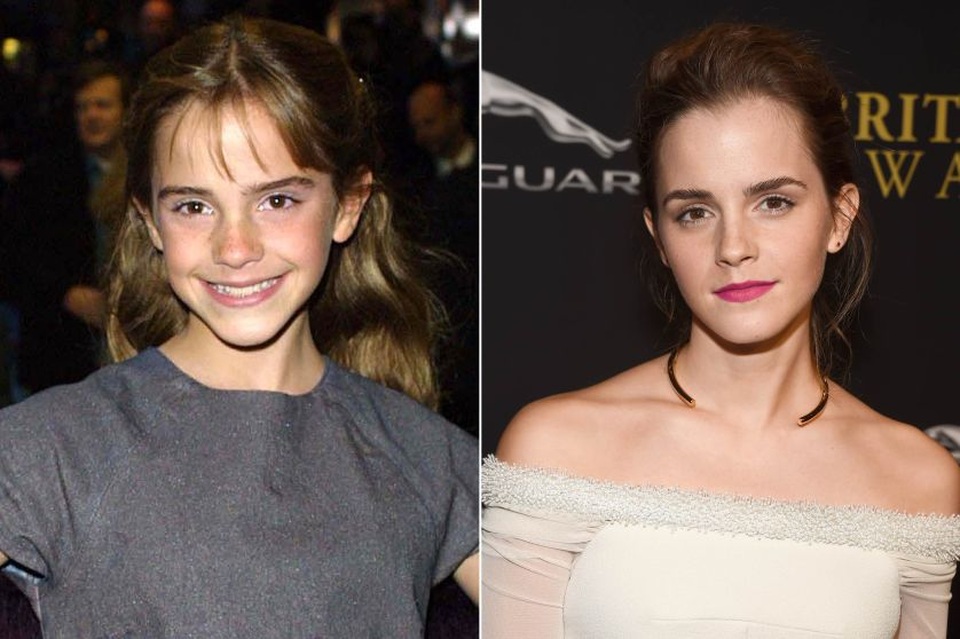 Nữ diễn viên Emma Watson (26 tuổi) thường được nhắc tới với biệt danh “bông hồng Anh” bởi nhan sắc và hình tượng đẹp mà cô đưa lại cho công chúng. Được biết tới từ khi còn là một diễn viên nhí xuất hiện trong loạt phim đình đám Harry Potter, hiện giờ, Emma Watson đã là một ngôi sao điện ảnh quyến rũ, tài năng và trí tuệ. Nhan sắc của Emma Watson đã luôn nằm trong “tầm ngắm” của truyền thông và công chúng kể từ khi cô còn là một cô bé. Người ta có thể chắc chắn rằng vẻ đẹp ấy hoàn toàn tự nhiên.