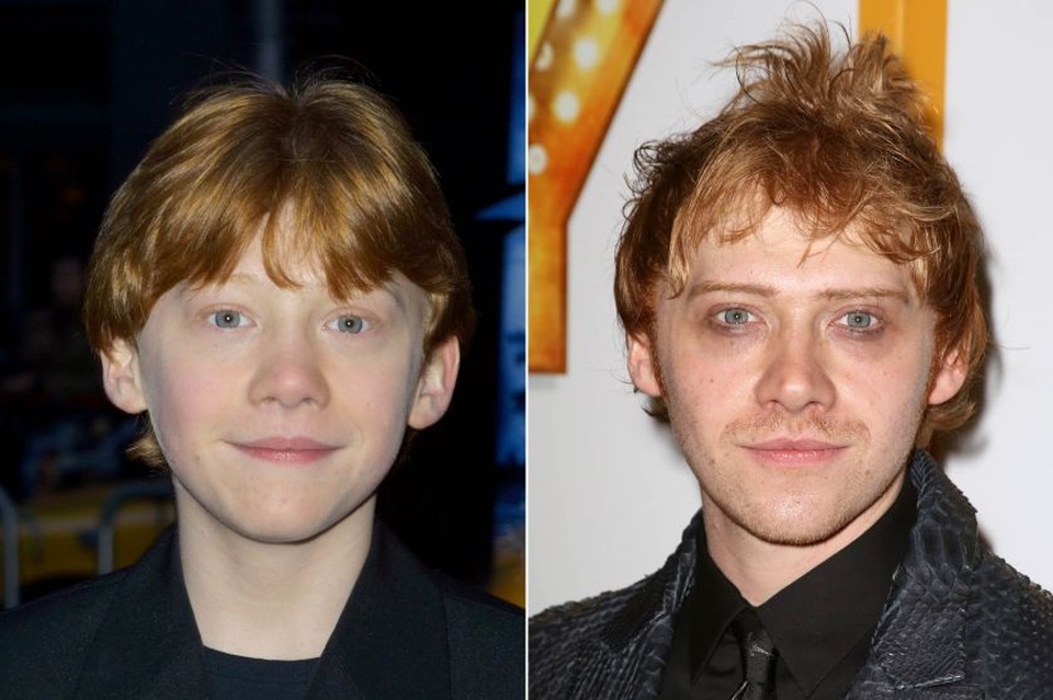 Nam diễn viên Rupert Grint từng đảm nhiệm vai Ronald Weasley trong loạt phim đình đám Harry Potter. Sau vai diễn ấn tượng này, sự nghiệp diễn xuất không mỉm cười với Rupert Grint, và dường như thời gian cũng không “hậu đãi” cho sự trưởng thành của cậu thanh niên 28 tuổi, bởi cậu bé tóc đỏ xinh xắn năm xưa giờ có nhiều nét “phôi pha” vì năm tháng.