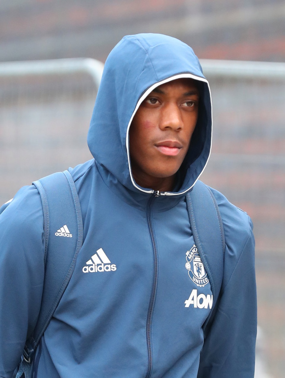 Bộ mặt lạnh lùng thường thấy của Martial