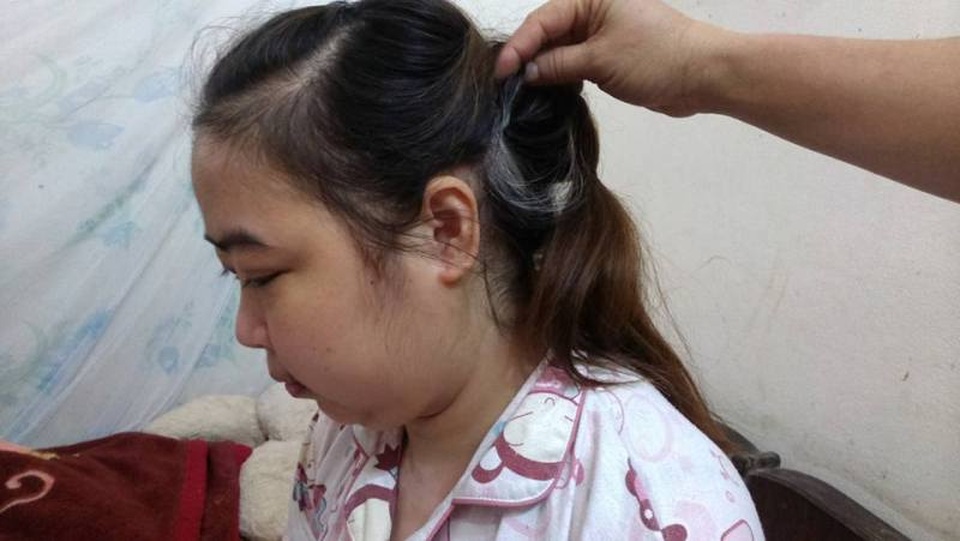 Không đủ tiền phẫu thuật, cô gái trẻ đối diện với tử thần - 3