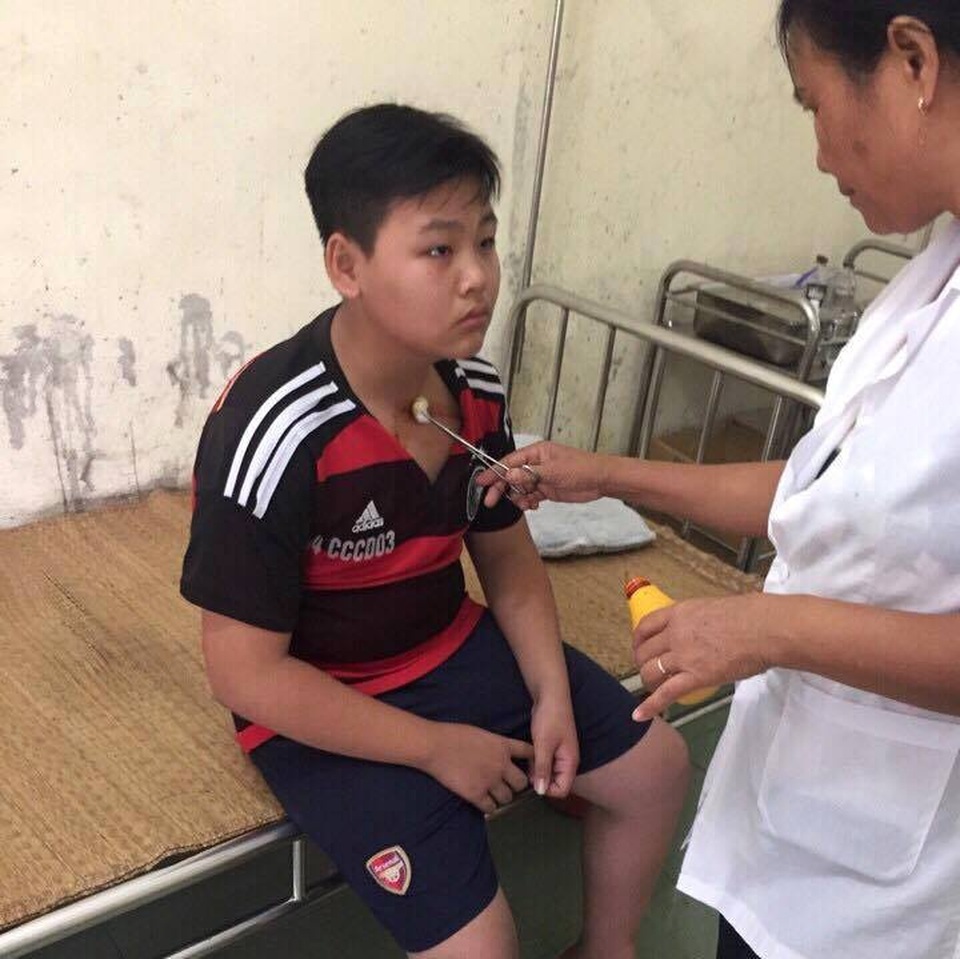 Học sinh lớp 8 bị thầy giáo hành hung đến thương tích? - 3 Ngay sau khi bị thầy giáo hành hung, T phải điều đến trạm y tế để điều trị