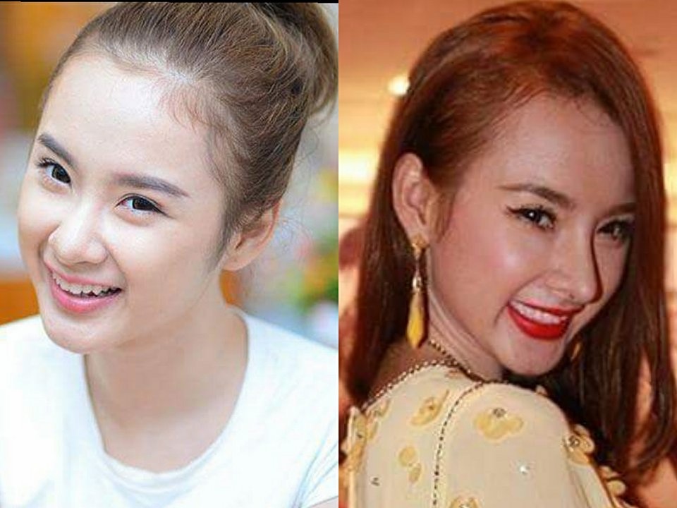 Nhìn lại "hành trình nhan sắc" ngày càng khác lạ của Angela Phương Trinh - 3 Hình ảnh so sánh chiếc mũi của Angela Phương Trinh trước và sau khi phẫu thuật thu gọn cánh mũi, nâng cao sóng mũi.