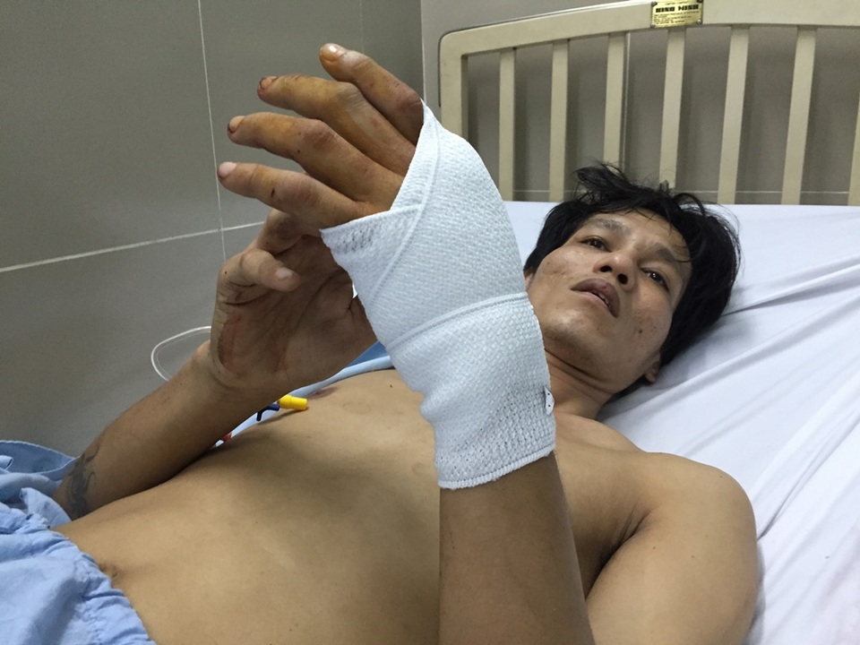 Anh Lâm với vết thương ở tay