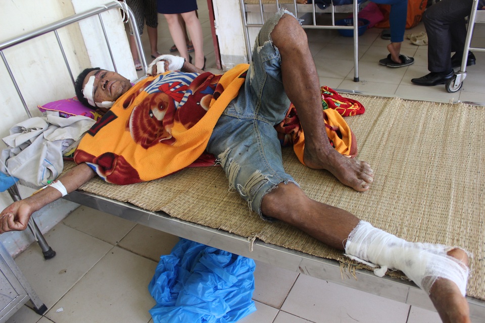 Bị lợn rừng tấn công, một người nhập viện với 14 vết thương - 1 Ông An bị lợn cắn 14 vết trên cơ thể.