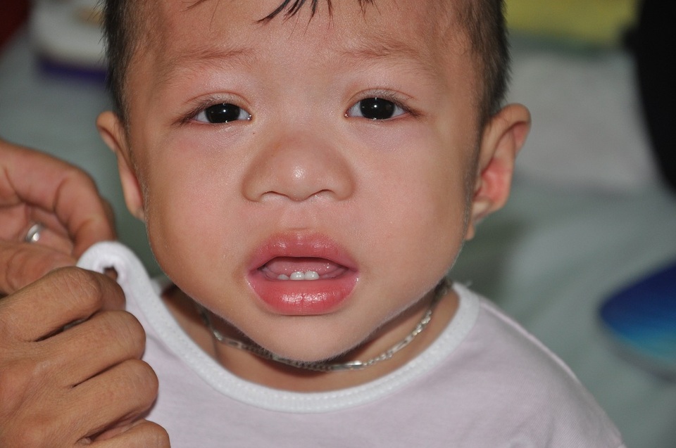 Nhờ sự kết nối của phòng CTXH đến các nhà hảo tâm nên em đã được cứu sống.