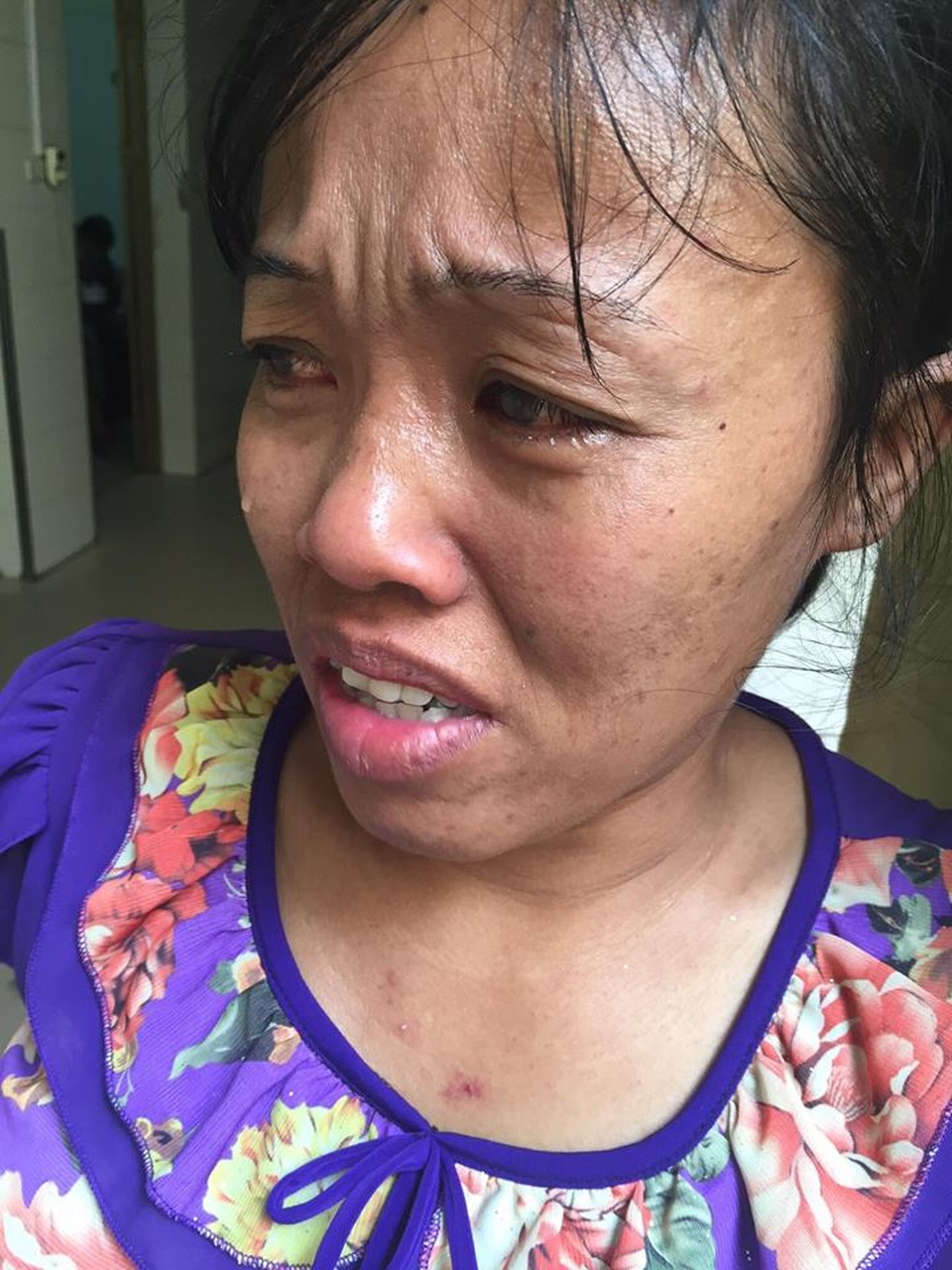 "Con gái chị bị điện giật chết, giờ chồng chị cũng sắp chết vì ung thư em ơi !" - 1 Mang trong mình khối u gan, xơ gan nhưng chị Hiền không có tiền đi chữa trị.