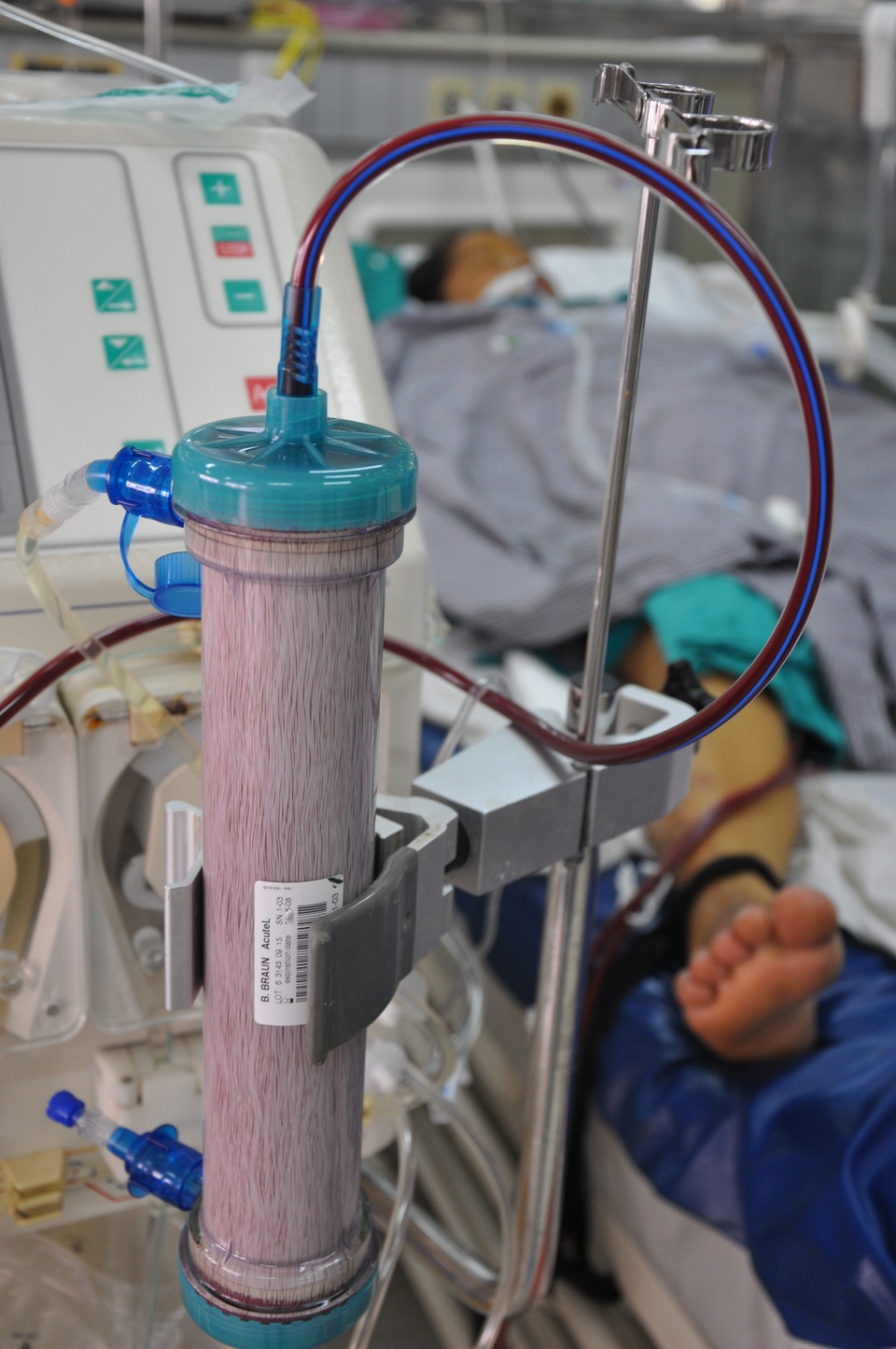 Sau ca mổ đẻ, 4 tiếng sau chị Huyền phải mổ tiếp vì khoang bụng chứa đầy máu.