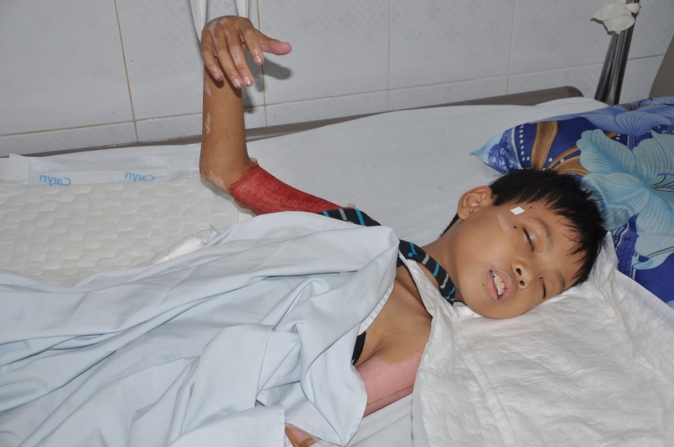 Em trai của Hằng cũng đang điều trị ở đây.