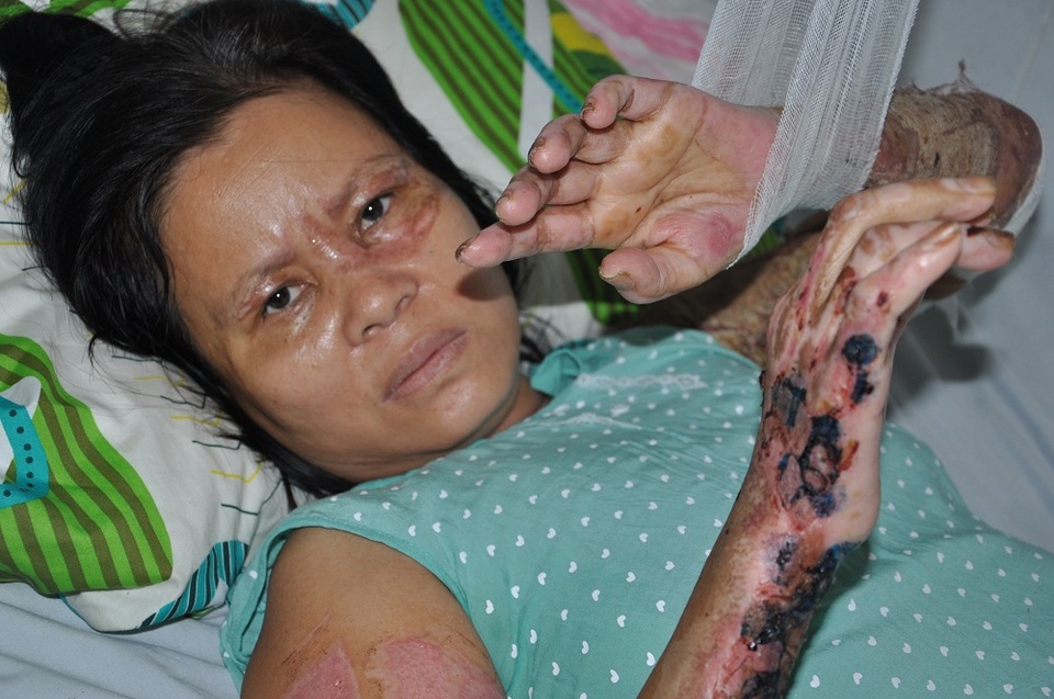 Cô Hồng vẫn chưa biết tin con gái qua đời.