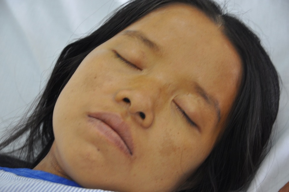 Sau 1 thời gian điều trị, chị đã được cứu sống.