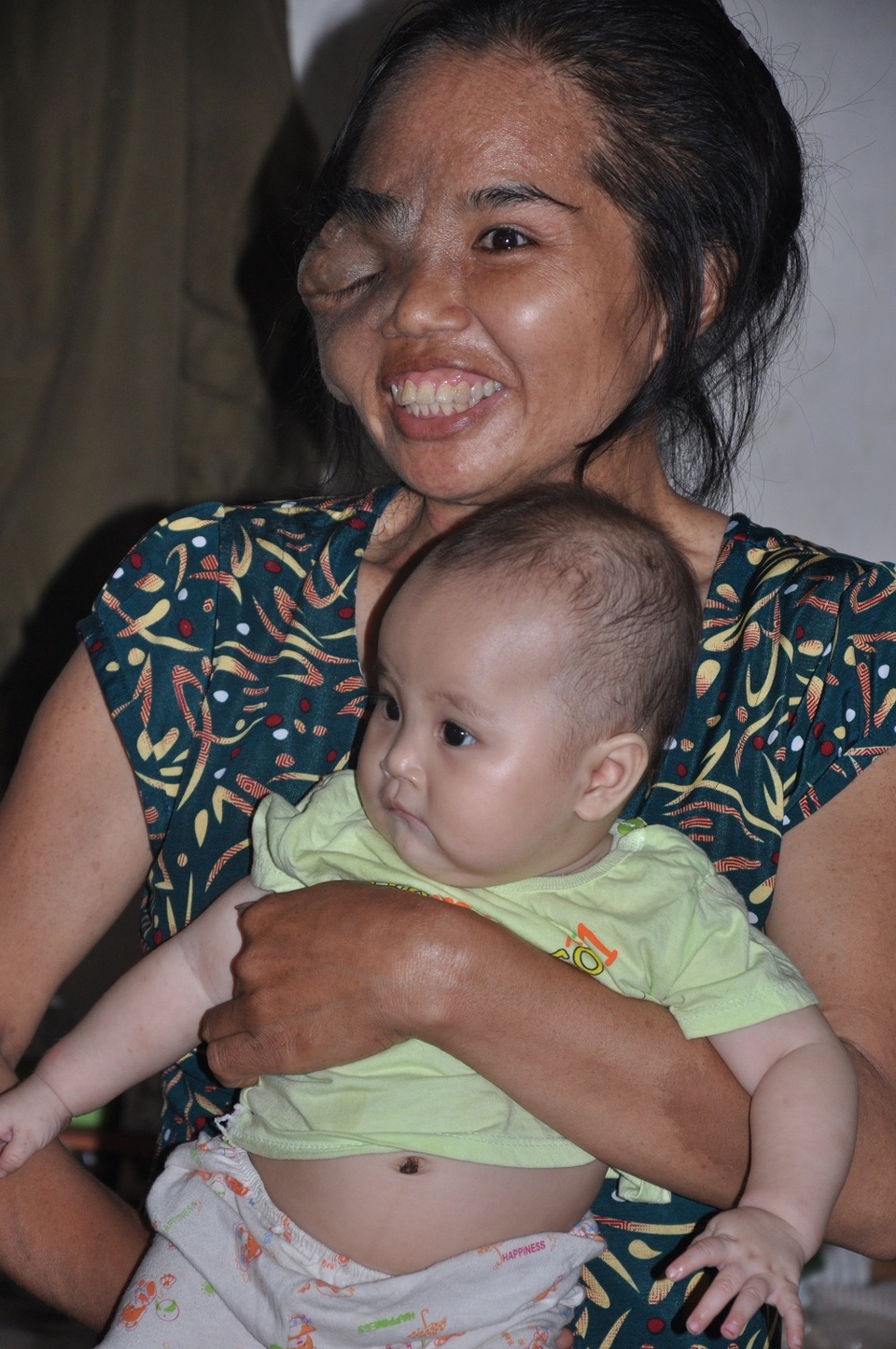 Cô bé Phương Anh được mọi người cho nhiều sữa, quần áo...