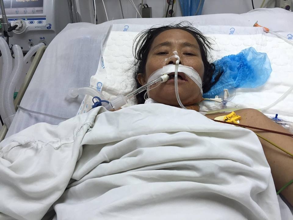 Gần 100 triệu đồng đến với người mẹ đáng thương bị tim nặng - 1 Chị Hòa đã trải qua ca mổ và đang trong giai đoạn hồi sức tích cực.