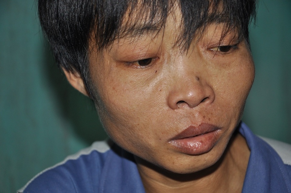 Bố bị tan máu bẩm sinh nhưng đã nhiều năm không có tiền lên viện chữa trị.