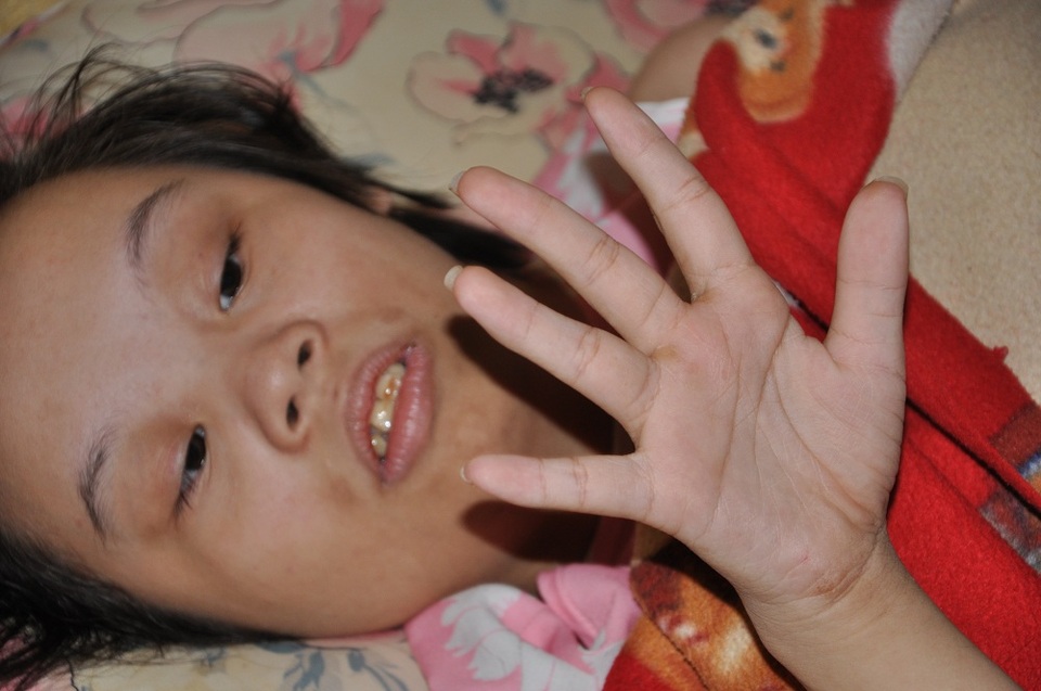 Con gái đầu của chị Hậu bị bệnh Down không biết gì