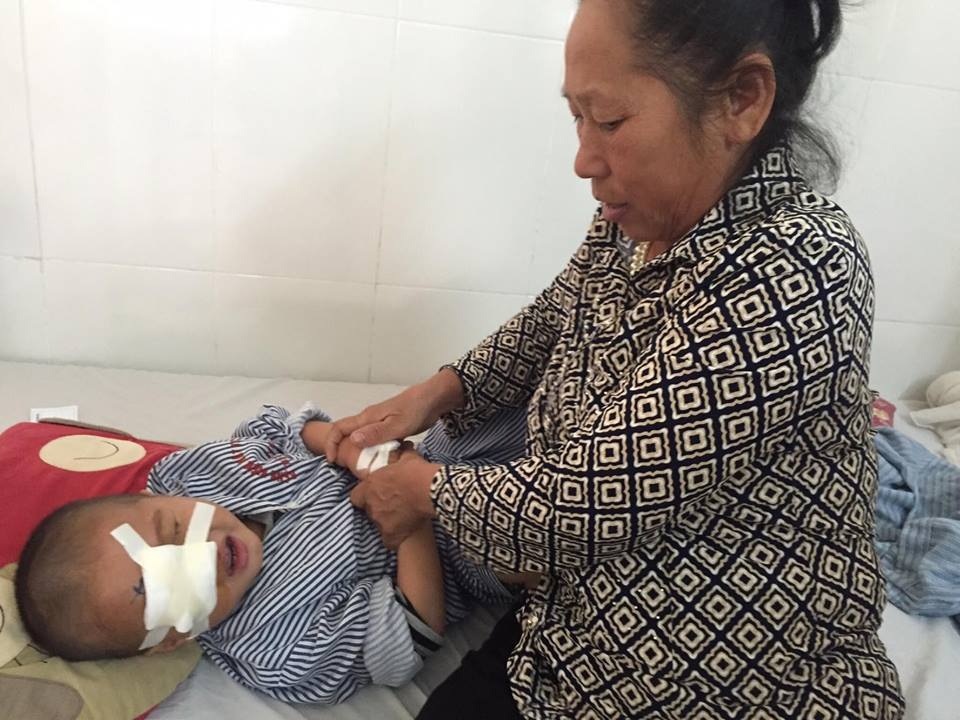 Bố mất, mẹ bị tâm thần, bé 4 tuổi lại nguy kịch vì bệnh ung thư - 6 Sau ca mổ cô Xía phải giữ tay bé Lanh để bé không cậy băng ở mắt ra.